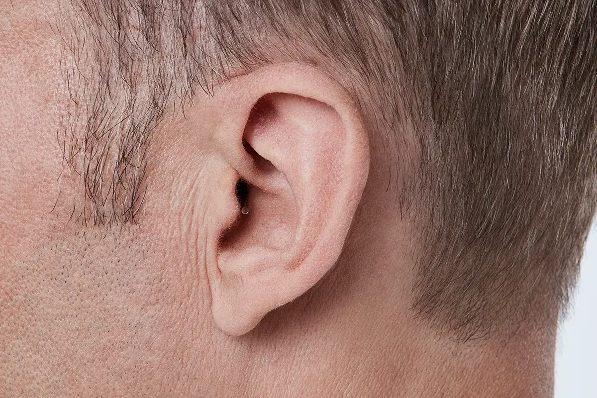 Orelha de um homem usando aparelho invisível no canal: não dá para notar