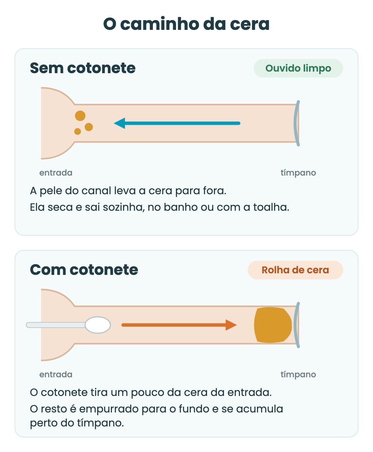 Infográfico em dois quadros. No primeiro, a limpeza natural: a pele do canal leva a cera para fora e ela sai sozinha. No segundo, o cotonete: ele tira um pouco da cera da entrada, empurra o resto para o fundo e forma a rolha de cera perto do tímpano