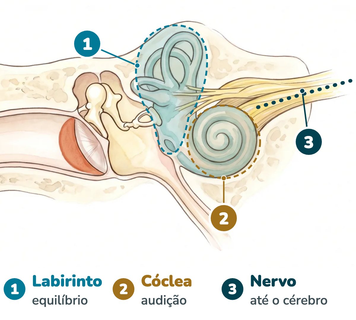 Ilustração da orelha interna em corte com três destaques: os canais semicirculares do labirinto, que cuidam do equilíbrio; a cóclea em espiral, ao lado, que cuida da audição; e o nervo que leva os sinais dos dois até o cérebro